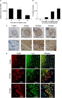 Crucial Involvement of IL-6 in Thrombus Resolution in Mice via Macrophage Recruitment and the Induction of Proteolytic Enzymes